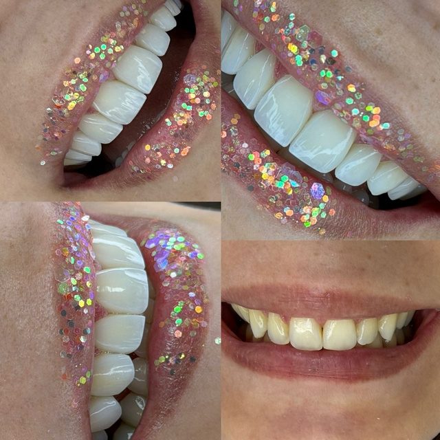 Resultado de tratamiento dental